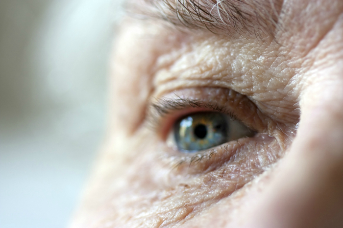 Age-Related-Macular-Degeneration-a-Frustrating-Condition-to-Live-with-and-Treat